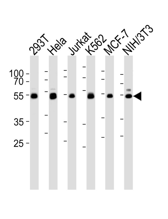 NEK2 Antibody - Western blot of lysates from 293T, HeLa, Jurkat, K562, MCF-7, and mouse NIH/3T3 cell line (from left to right), using NEK2 Antibody (C410). Antibody was diluted at 1:1000 at each lane. A goat anti-rabbit IgG H&L (HRP) at 1:5000 dilution was used as the secondary antibody. Lysates at 35ug per lane.