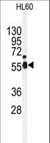 NEK2 Antibody - Western blot of anti-NEK2 Antibody in HL60 cell line lysates (35 ug/lane). NEK2(arrow) was detected using the purified antibody.