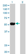 NEK2 Antibody - Western blot of NEK2 expression in transfected 293T cell line by NEK2 monoclonal antibody clone 2F6.