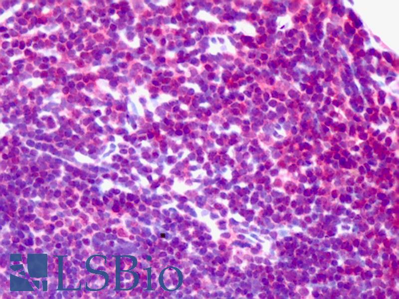 NEK2 Antibody - Anti-NEK2 antibody IHC of human colon. Immunohistochemistry of formalin-fixed, paraffin-embedded tissue after heat-induced antigen retrieval. Antibody concentration 2.5 ug/ml.