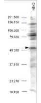 NEK2 Antibody - Anti-NEK2 Antibody - Western Blot. Western blot analysis is shown using Affinity Purified anti-NEK2 antibody to detect endogenous protein present in an unstimulated mouse A-20 whole cell lysate (arrowhead). Comparison to a molecular weight marker indicates a band of ~52 kD corresponding to NEK2 protein. The blot was incubated with a 1:500 dilution of the antibody at room temperature followed by detection using standard techniques. Personal communication Steven Pelech, Kinexus Inc.