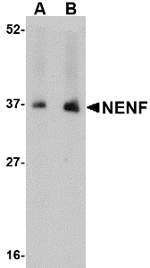 NENF / Neudesin Antibody - Western blot of NENF in human kidney tissue lysate with NENF antibody at (A) 1 and (B) 2 ug/ml.