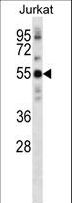 NETO2 Antibody - NETO2 Antibody (N-term ) western blot of Jurkat cell line lysates (35 ug/lane). The NETO2 antibody detected the NETO2 protein (arrow).