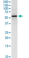 NEU1 / NEU Antibody - NEU1 monoclonal antibody (M01), clone 3F9. Western Blot analysis of NEU1 expression in IMR-32.