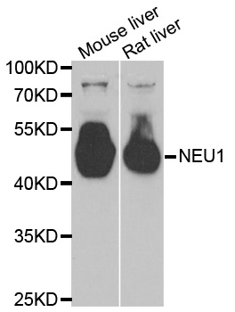 NEU1 / NEU Antibody - Western blot analysis of extracts of various cell lines, using NEU1 antibody.
