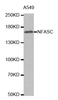Neurofascin / NF Antibody - Western blot analysis of extracts of A549 cell lysate, using NFASC antibody.