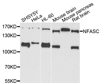 Neurofascin / NF Antibody - Western blot analysis of extracts of various cells.