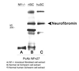Neurofibromin / NF1 Antibody - Neurofibromin Antibody - Western Blot of (A, B, C above).