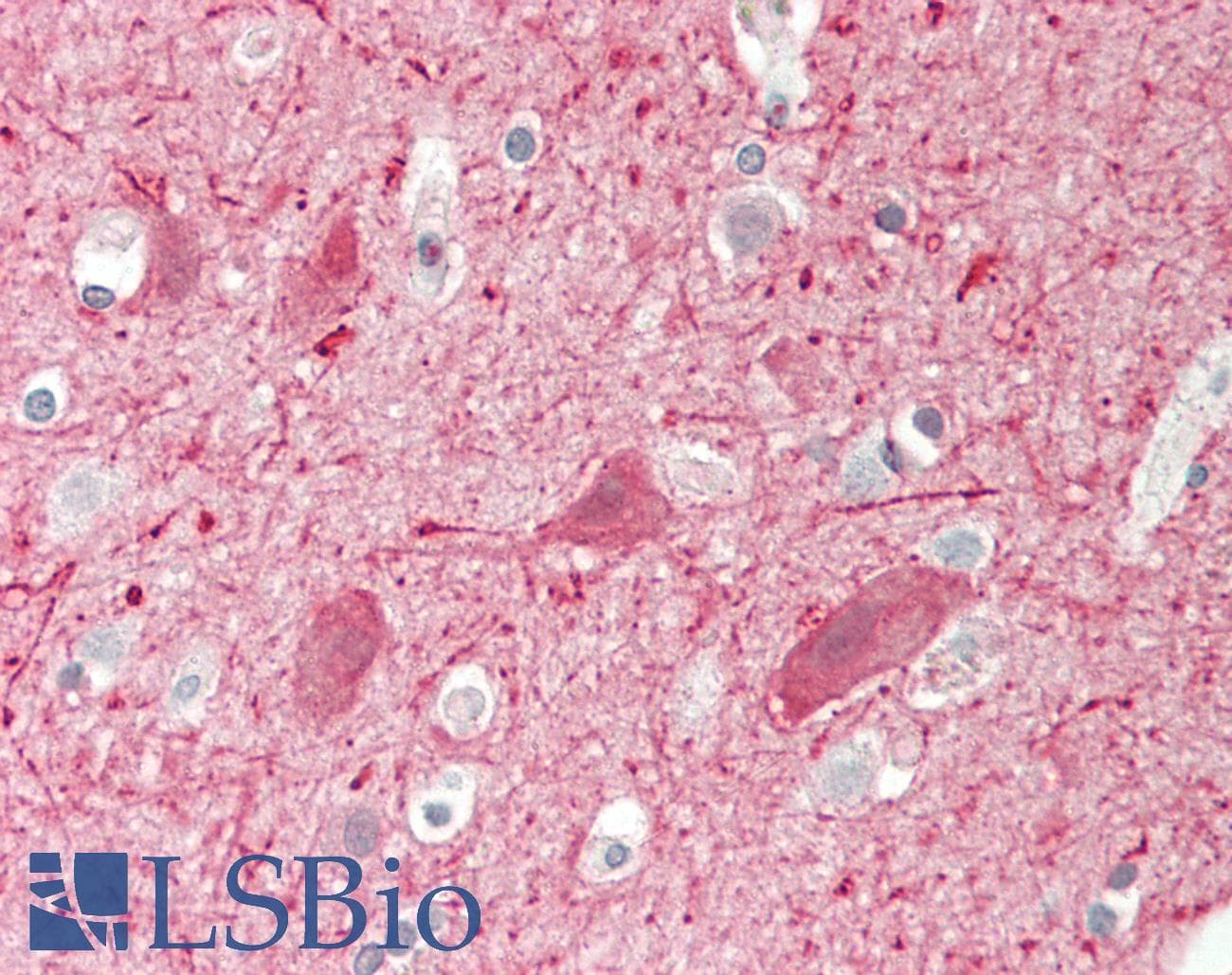 Neurofilament Antibody - Human Brain, Cortex: Formalin-Fixed, Paraffin-Embedded (FFPE)