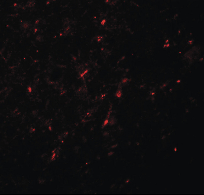 NEUROG2 / NGN2 / Neurogenin 2 Antibody - Immunofluorescence of NGN2 in human brain tissue with NGN2 antibody at 20 ug/ml.