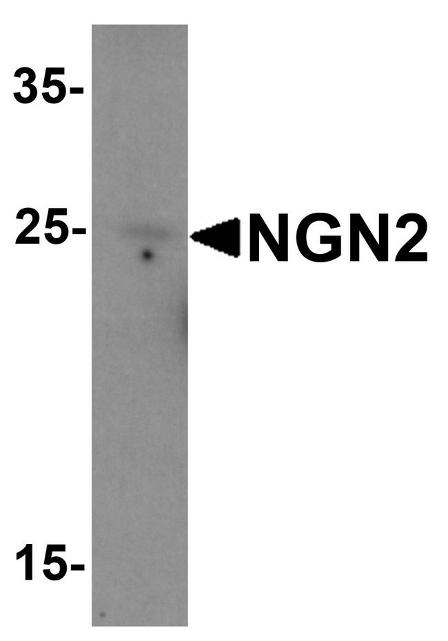 NEUROG2 / NGN2 / Neurogenin 2 Antibody - Western blot analysis of NGN2 in mouse small intestine tissue lysate with NGN2 antibody at (A) 1 and (B) 2 ug/ml.