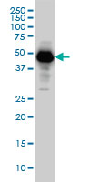 Neuroserpin Antibody - SERPINI1 monoclonal antibody, Western blot of SERPINI1 expression in HeLa.