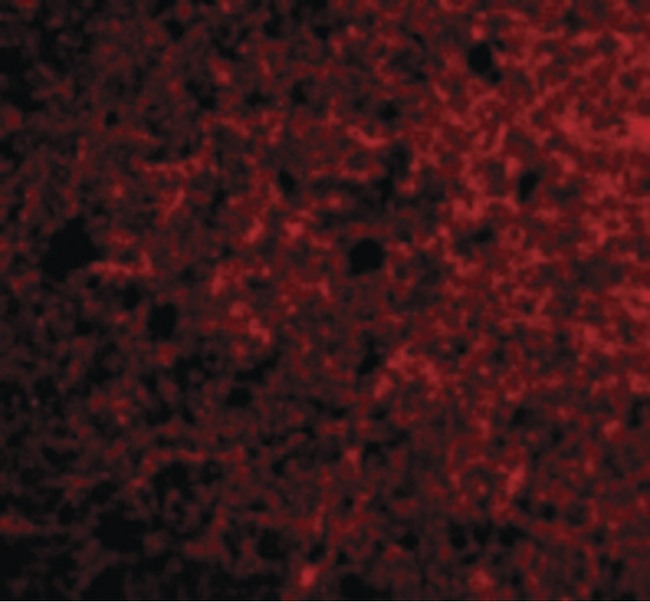Neurotrypsin Antibody - Immunofluorescence of Neurotrypsin in Human Brain cells with Neurotrypsin antibody at 20 ug/ml.