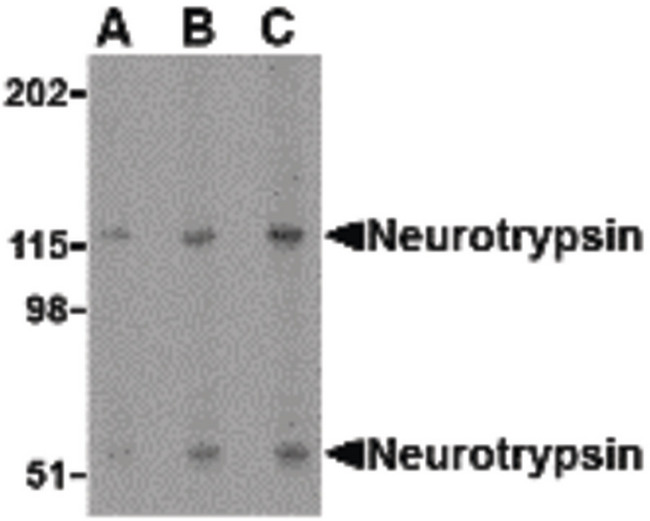 Neurotrypsin Antibody - Western blot of neurotrypsin in SK-N-SH cell lysate with neurotrypsin antibody at (A) 0.5, (B) 1 and (C) 2 ug/ml.