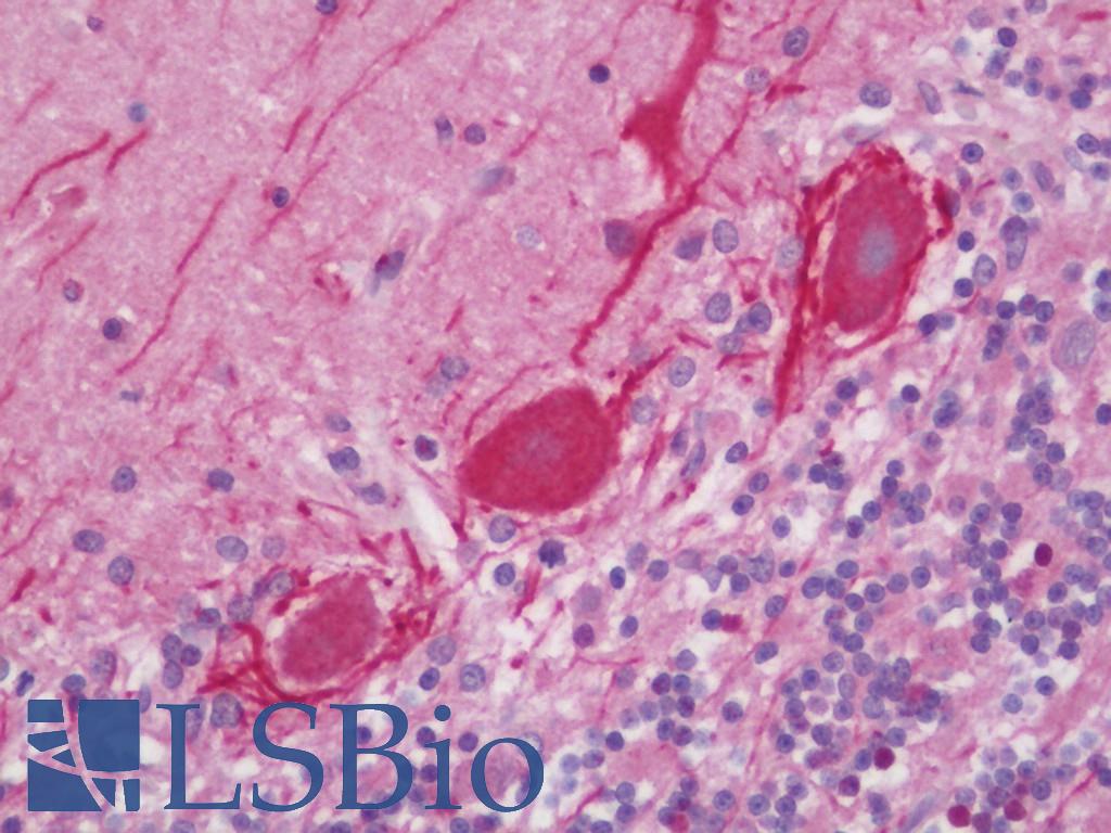 NF-L / NEFL Antibody - Human Brain, Cerebellum: Formalin-Fixed, Paraffin-Embedded (FFPE) 