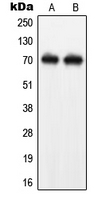 NF-L / NEFL Antibody - Western blot analysis of NEFL expression in SHSY5Y (A); Jurkat (B) whole cell lysates.
