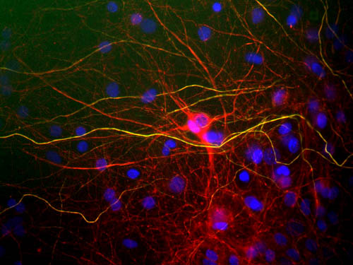 NF-L / NEFL Antibody - View of mixed neuron/glial cultures stained with NF-L / NEFL antibody (red) and rabbit antibody to phosphorylated NF-H (green). The NF-L protein is assembled into neurofilaments which are found throughout the axons, dendrites and perikarya of these cells. In contrast the phosphorylated NF-H has a much more restricted expression pattern, being found only in developed axonal neurofilaments. Since both proteins are found in neurofilaments, the red and green patterns overlap, so that neurofilaments containing NF-L and phosphorylated NF-H appear yellowish. In contrast neurofilaments containing only NF-L appear red.