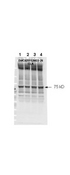 NF2 / Merlin Antibody - Anti-Human NF2 (Merlin) pS518 Antibody - Western Blot. Affinity purified phospho-specific antibody to NF2 (Merlin) at pS518 was used at a 1:1000 dilution to detect NF2 by Western blot. Approximately 12 ul of a mouse cardiac myocyte lysate was loaded per lane on a 4-20% Criterion gel for SDS-PAGE. Samples were either mock treated (lane 1) or CLA treated at 4nM, 20 nM or 100 nM (lanes 2, 3 and 4 respectively) for 45. After washing, a 1:5000 dilution of HRP conjugated Gt-a-Rabbit IgG (LS-C60865) preceded color development using Amershams substrate system. Other detection methods will yield similar results.