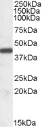 NF45 / ILF2 Antibody - NF45 / ILF2 antibody (0.03µg/ml) staining of Human Tonsil lysate (35µg protein in RIPA buffer). Primary incubation was 1 hour. Detected by chemiluminescence.