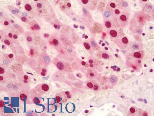 NF90 / ILF3 Antibody - Anti-NF90 / ILF3 antibody IHC staining of human liver. Immunohistochemistry of formalin-fixed, paraffin-embedded tissue after heat-induced antigen retrieval. Antibody dilution 1:50.