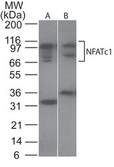 NFATC1 / NFAT2 Antibody - Western blot of NFATc1 in Ramos cell lysate. Lane 1. Without blocking peptide. Lane 2. With blocking peptide.