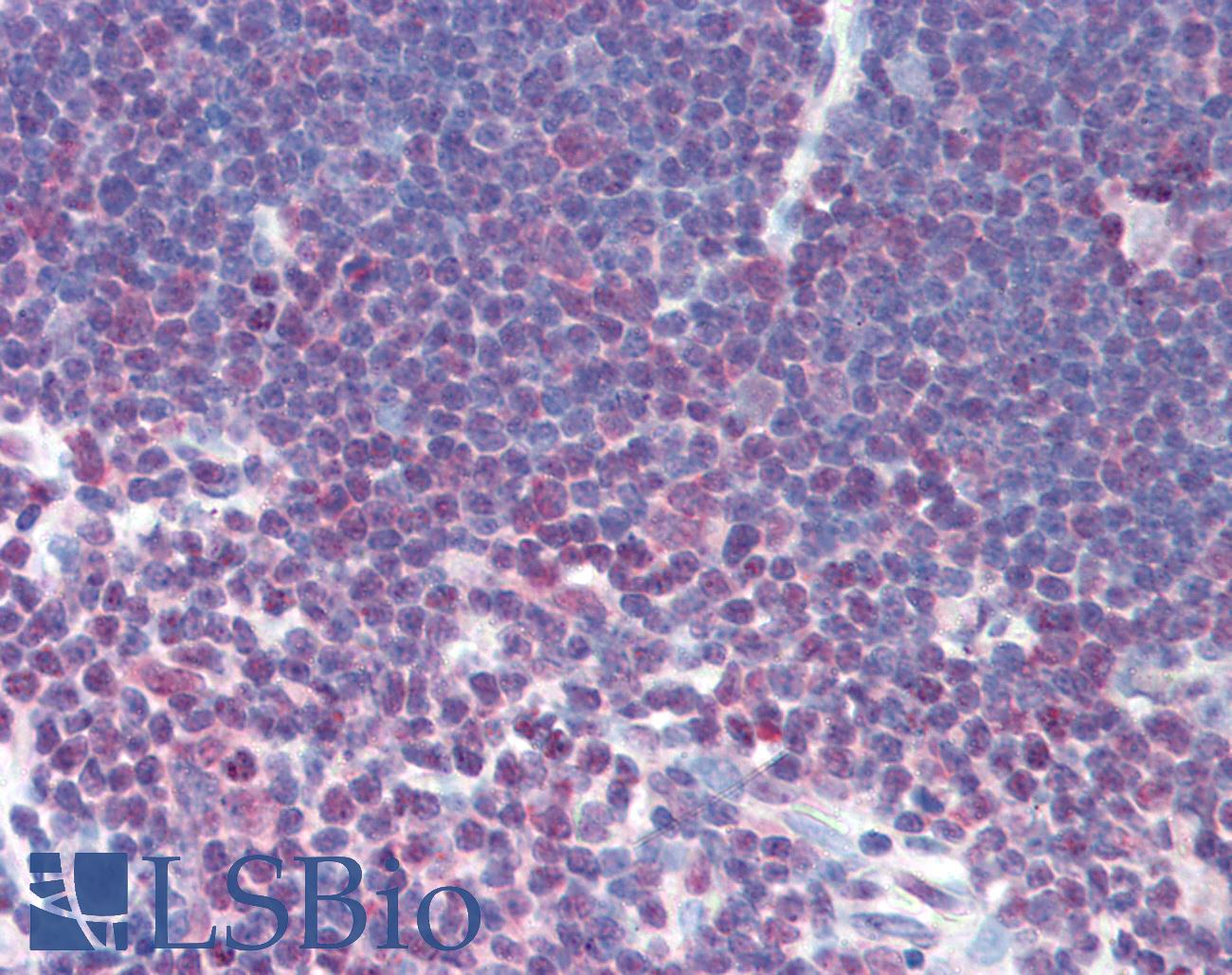 NFATC1 / NFAT2 Antibody - Anti-NFATC1 antibody IHC of human thymus. Immunohistochemistry of formalin-fixed, paraffin-embedded tissue after heat-induced antigen retrieval. Antibody concentration 10 ug/ml.