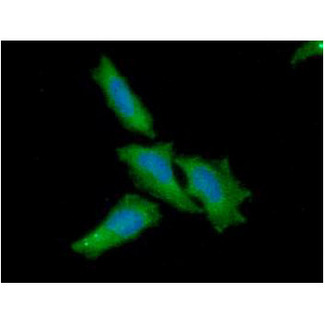 NFATC1 / NFAT2 Antibody - IF (ICC) notes: ICC/IF analysis of NFATc1 in HaLe cells. The cell was stained with NFATc1 antibody (1:100). The secondary antibody (green) was used Alexa Fluor 488. DAPI was stained the cell nucleus (blue).