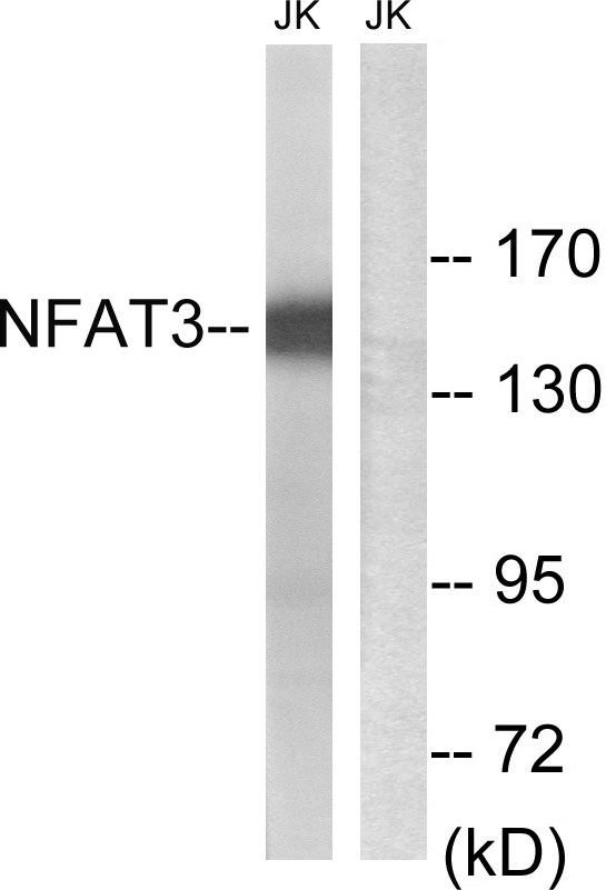NFATC4 / NFAT3 Antibody - Western blot analysis of lysates from Jurkat cells, using NFAT3 Antibody. The lane on the right is blocked with the synthesized peptide.