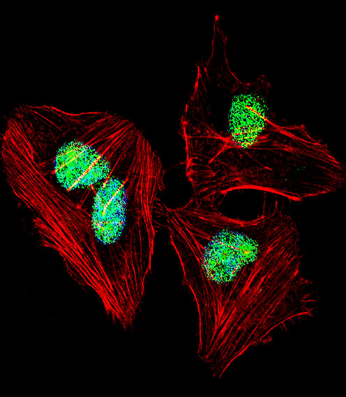 NFIA / Nuclear Factor 1 Antibody - Fluorescent confocal image of HeLa cell stained with NFIA Antibody. HeLa cells were fixed with 4% PFA (20 min), permeabilized with Triton X-100 (0.1%, 10 min), then incubated with NFIA primary antibody (1:25, 1 h at 37°C). For secondary antibody, Alexa Fluor 488 conjugated donkey anti-rabbit antibody (green) was used (1:400, 50 min at 37°C). Cytoplasmic actin was counterstained with Alexa Fluor 555 (red) conjugated Phalloidin (7units/ml, 1 h at 37°C). Nuclei were counterstained with DAPI (blue) (10 ug/ml, 10 min). NFIA immunoreactivity is localized to Nucleus significantly.