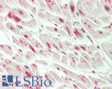 NFIB Antibody - Human Heart: Formalin-Fixed, Paraffin-Embedded (FFPE)