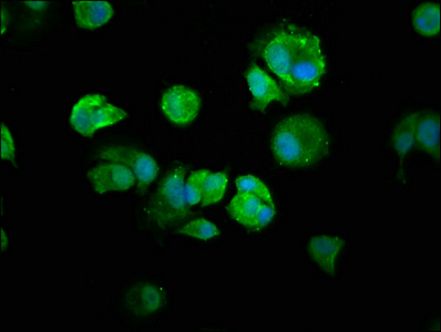 NFKB1 / NF-Kappa-B Antibody - Immunofluorescence staining of MCF-7 cells with NFKB1 Antibody at 1:250, counter-stained with DAPI. The cells were fixed in 4% formaldehyde, permeabilized using 0.2% Triton X-100 and blocked in 10% normal Goat Serum. The cells were then incubated with the antibody overnight at 4°C. The secondary antibody was Alexa Fluor 488-congugated AffiniPure Goat Anti-Rabbit IgG(H+L).