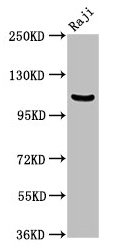 NFKB1 / NF-Kappa-B Antibody - Western Blot Positive WB detected in: Raji whole cell lysate All lanes: NFKB1 antibody at 3.75µg/ml Secondary Goat polyclonal to rabbit IgG at 1/50000 dilution Predicted band size: 106, 86 kDa Observed band size: 106 kDa
