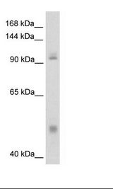 NFKB1 / NF-Kappa-B Antibody - Fetal Thymus Lysate.  This image was taken for the unconjugated form of this product. Other forms have not been tested.
