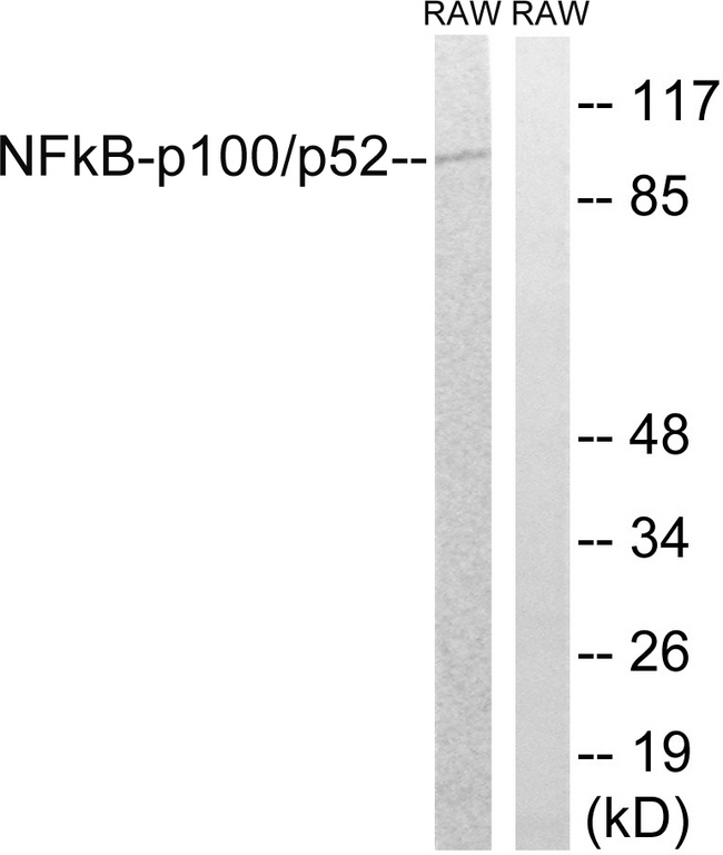 NFKB2 Antibody - Western blot analysis of lysates from RAW264.7 cells, using NF-kappaB p100/p52 Antibody. The lane on the right is blocked with the synthesized peptide.