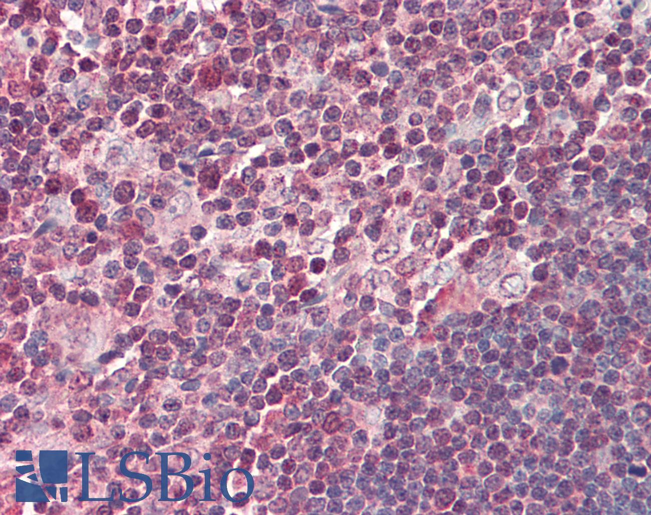 NFKB2 Antibody - Human Thymus: Formalin-Fixed, Paraffin-Embedded (FFPE)