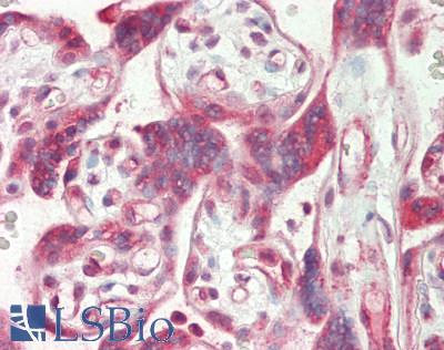 NFKBIA / IKB Alpha / IKBA Antibody - Human Placenta: Formalin-Fixed, Paraffin-Embedded (FFPE)
