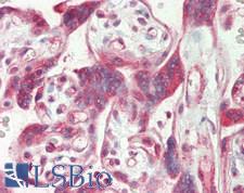 NFKBIA / IKB Alpha / IKBA Antibody - Human Placenta: Formalin-Fixed, Paraffin-Embedded (FFPE)