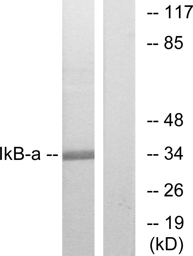 NFKBIA / IKB Alpha / IKBA Antibody - Western blot analysis of lysates from MCF7 cells, treated with TNF-Î±, using IkappaB-alpha Antibody. The lane on the right is blocked with the synthesized peptide.