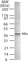 NFKBIA / IKB Alpha / IKBA Antibody - Western blot of NFKBIA in 20 ug of whole Jurkat cell lysate using NFKBIA antibody at 2 ug/ml.