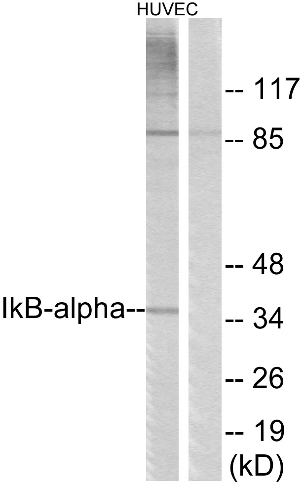 NFKBIA / IKB Alpha / IKBA Antibody - Western blot analysis of lysates from HUVEC cells, treated with TNF-Î± 20ng/ml 30', using IkappaB-alpha Antibody. The lane on the right is blocked with the synthesized peptide.
