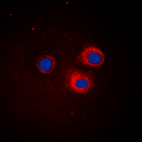 NFKBIE / IKB Epsilon Antibody - Immunofluorescent analysis of IKB epsilon staining in HepG2 cells. Formalin-fixed cells were permeabilized with 0.1% Triton X-100 in TBS for 5-10 minutes and blocked with 3% BSA-PBS for 30 minutes at room temperature. Cells were probed with the primary antibody in 3% BSA-PBS and incubated overnight at 4 deg C in a humidified chamber. Cells were washed with PBST and incubated with a DyLight 594-conjugated secondary antibody (red) in PBS at room temperature in the dark. DAPI was used to stain the cell nuclei (blue).