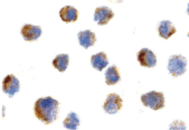 NGFR / CD271 / TNR16 Antibody - Immunocytochemistry of NGFR in A20 cells with NGFR antibody at 10 ug/ml.