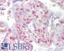 NHEJ1 / XLF Antibody - Anti-NHEJ1 antibody IHC of human placenta. Immunohistochemistry of formalin-fixed, paraffin-embedded tissue after heat-induced antigen retrieval. Antibody concentration 2.5 ug/ml.