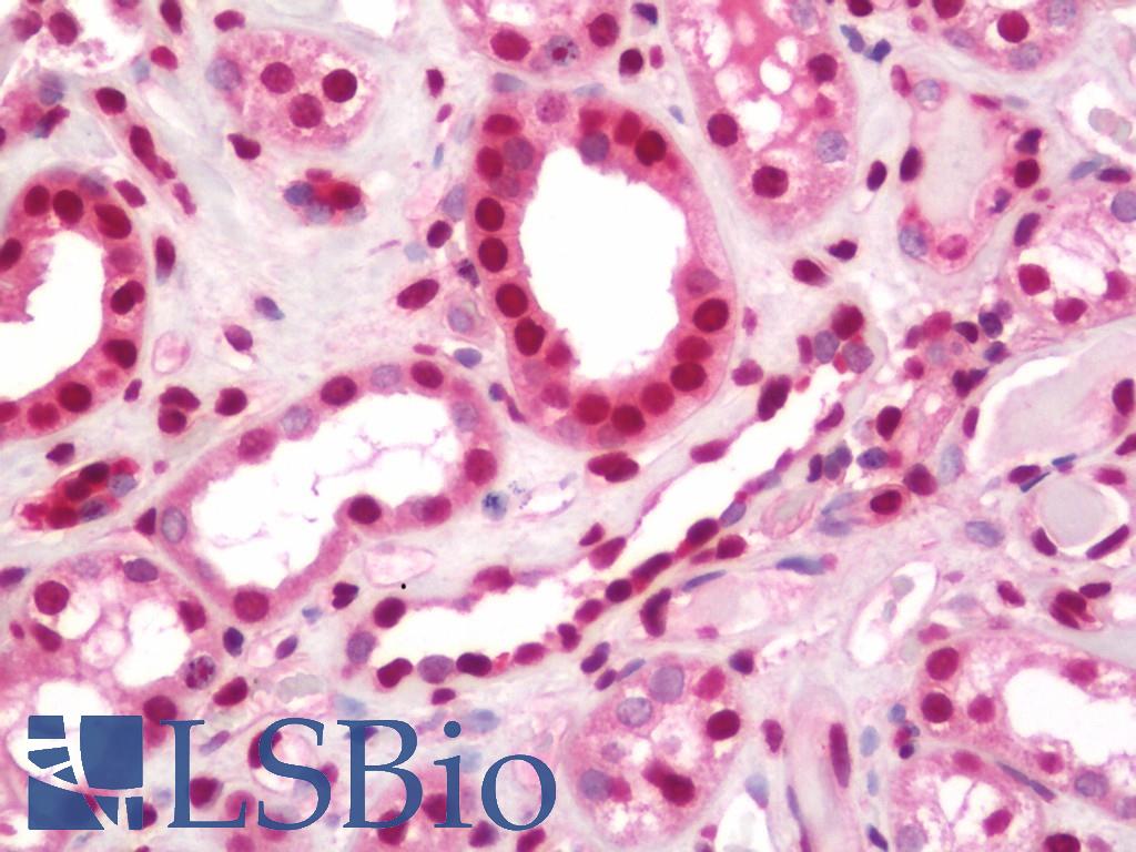 NHLH1 / HEN1 Antibody - Human Kidney: Formalin-Fixed, Paraffin-Embedded (FFPE)