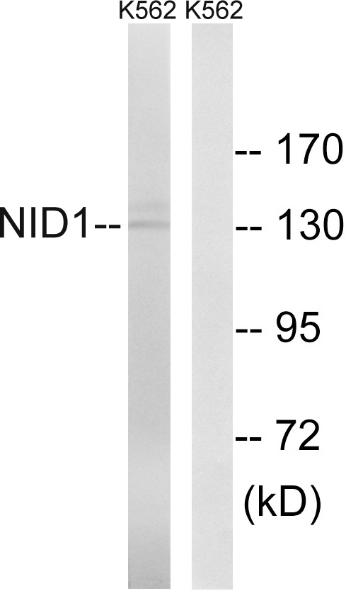 NID1 / Entactin / Nidogen-1 Antibody - Western blot analysis of lysates from K562 cells, using NID1 Antibody. The lane on the right is blocked with the synthesized peptide.