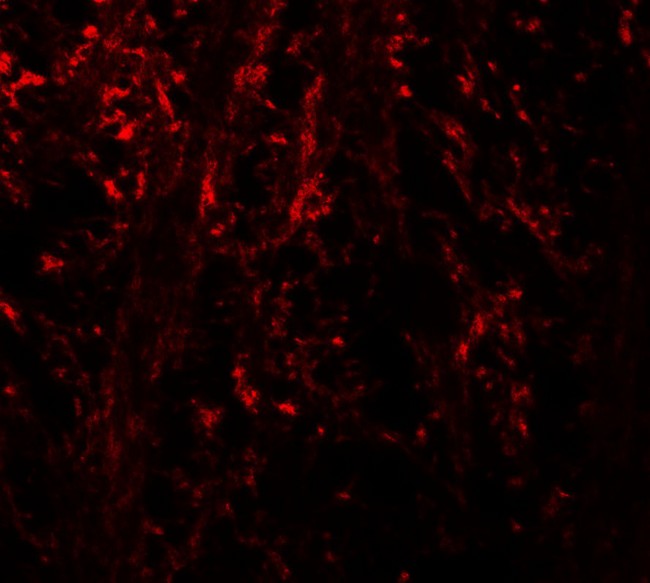 NINJ1 / Ninjurin Antibody - Immunofluorescence of NINJ1 in mouse brain tissue with NINJ1 antibody at 20 ug/ml.