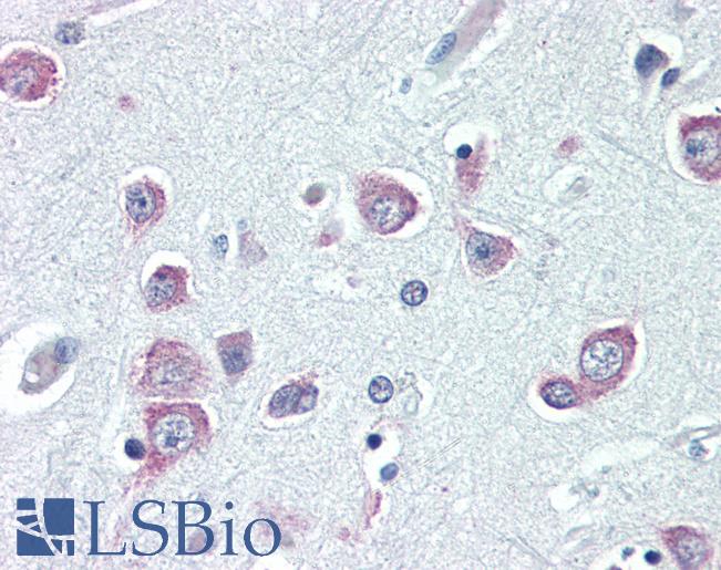 NIP3 / BNIP3 Antibody - Anti-BNIP3 antibody IHC of human brain, cortex. Immunohistochemistry of formalin-fixed, paraffin-embedded tissue after heat-induced antigen retrieval. Antibody concentration 10 ug/ml.