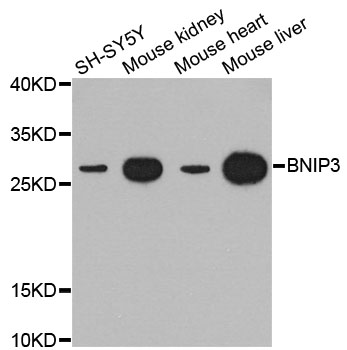 NIP3 / BNIP3 Antibody - Western blot analysis of extracts of various cell lines, using BNIP3 antibody.