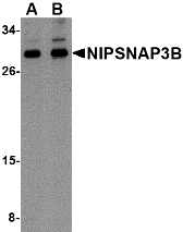 NIPSNAP3B Antibody - Western blot of NIPSNAP3B in mouse brain tissue lysate with NIPSNAP3B antibody at (A) 1 and (B) 2 ug/ml.