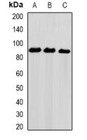 NIRF / UHRF2 Antibody - Western blot analysis of NIRF expression in HeLa (A); PC3 (B); THP1 (C) whole cell lysates.